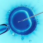 Comprehensive IVF Solutions