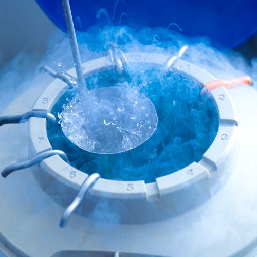 Semen Freezing in Chennai