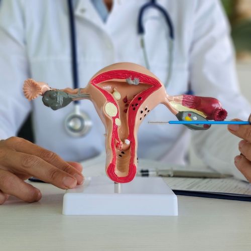 Hysteroscopic Septum Resection in Chennai