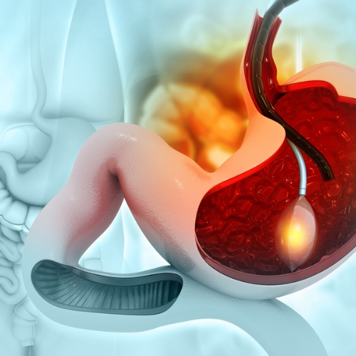 Pre-Marital Counselling in Chennai